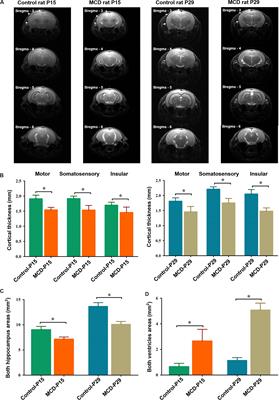 Delayed Functional Networks Development and Altered Fast Oscillation Dynamics in a Rat Model of Cortical Malformation